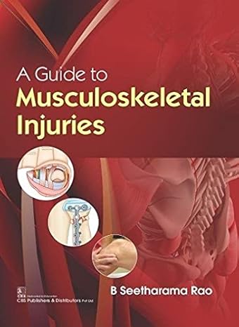 A Guide To Musculoskeletal Injuries (2022)